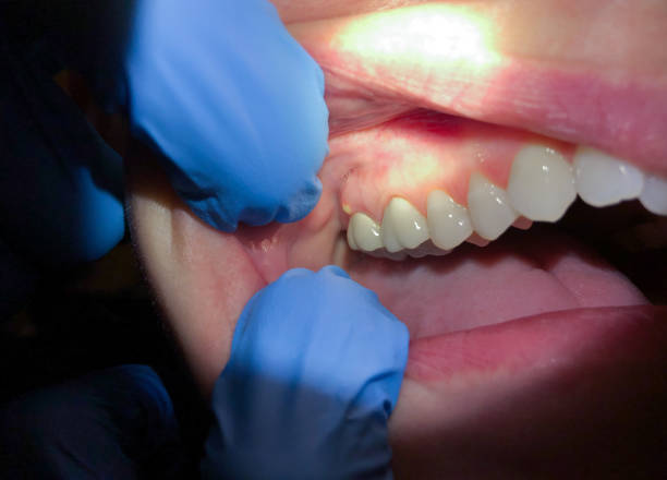 Best Pediatric Emergency Dentist in Maple Bluff, WI